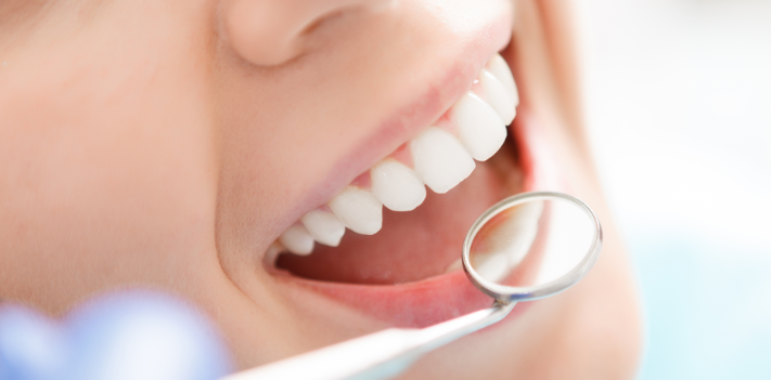 Dental Health Dental Health